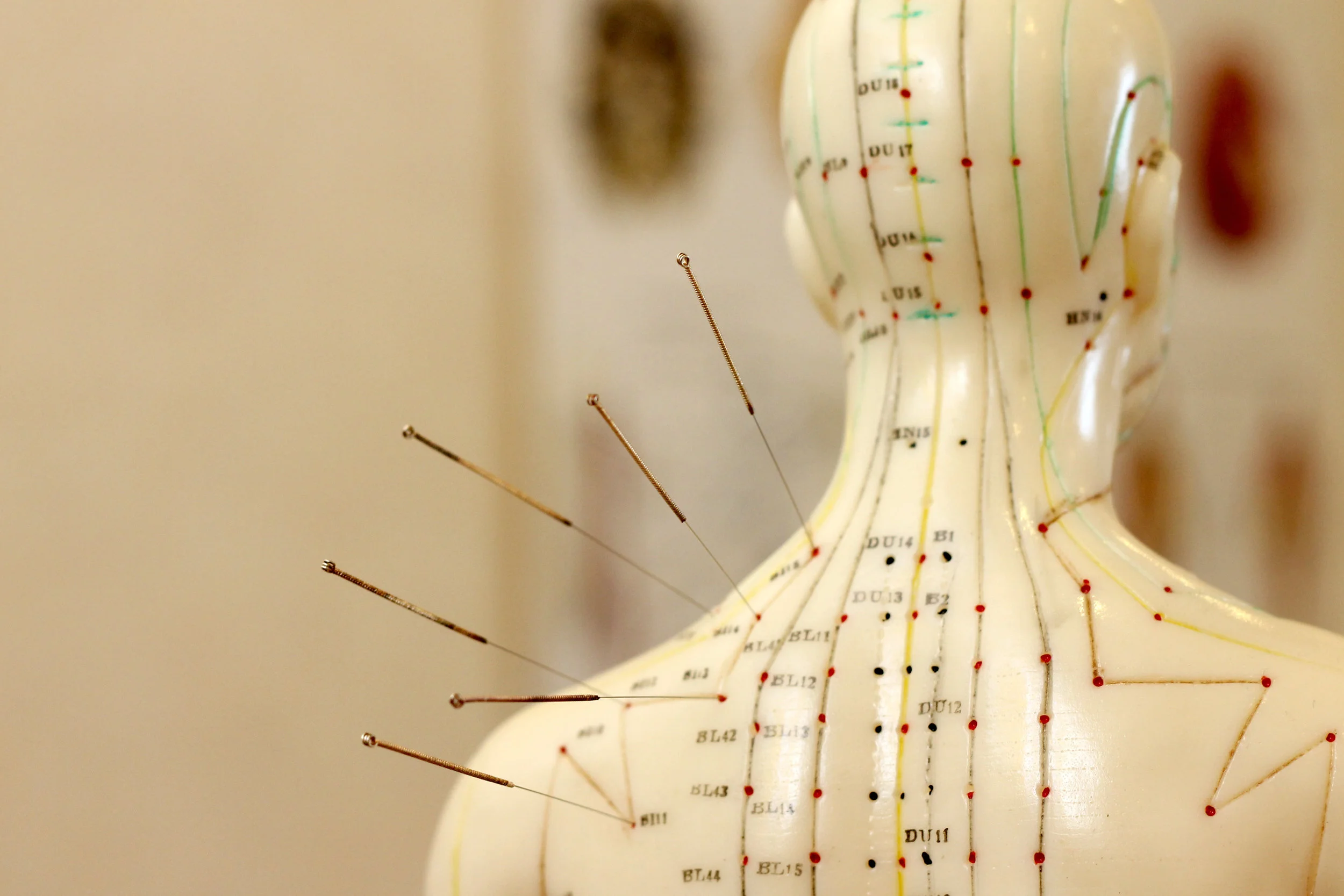 Acupuncture treatment