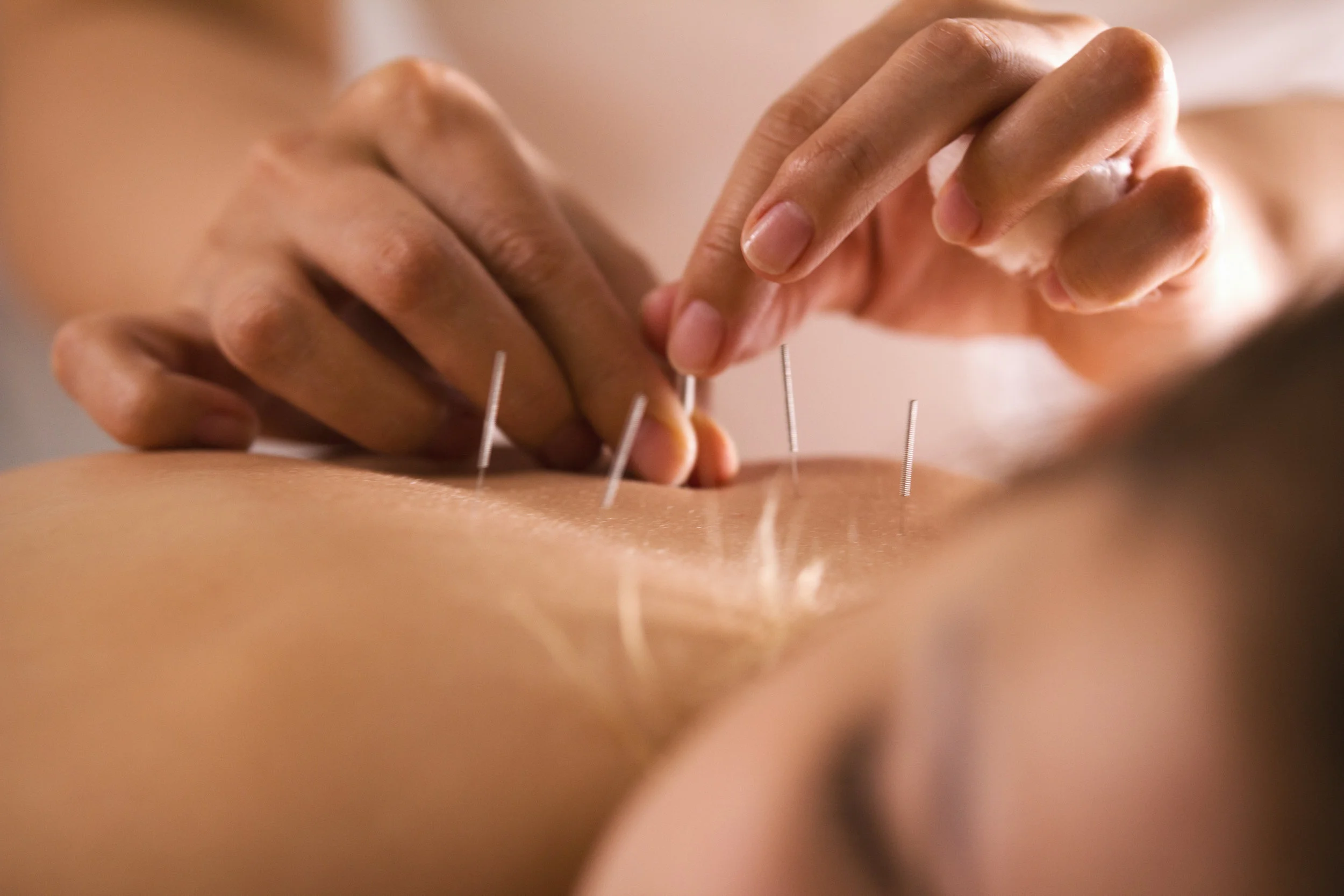 Acupuncture for women's health